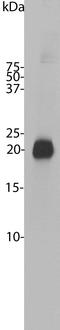 Visinin Like 1 antibody, LS-B10418, Lifespan Biosciences, Western Blot image 