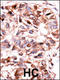 Protein Phosphatase, Mg2+/Mn2+ Dependent 1A antibody, LS-C101066, Lifespan Biosciences, Immunohistochemistry paraffin image 