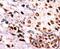 c-met antibody, PA5-12629, Invitrogen Antibodies, Immunohistochemistry paraffin image 