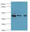 Ataxin 3 antibody, LS-C369297, Lifespan Biosciences, Western Blot image 