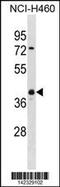 Ubiquitin C-Terminal Hydrolase L5 antibody, 60-847, ProSci, Western Blot image 