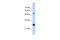 Immunoglobulin Superfamily Member 1 antibody, A05746, Boster Biological Technology, Western Blot image 