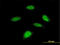 Ribosomal Protein S6 Kinase B2 antibody, LS-B12852, Lifespan Biosciences, Immunofluorescence image 