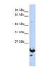 Nucleolar And Spindle Associated Protein 1 antibody, NBP1-53047, Novus Biologicals, Western Blot image 