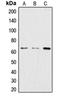 Cleavage Stimulation Factor Subunit 2 antibody, orb213797, Biorbyt, Western Blot image 