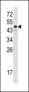 Serpin Family A Member 7 antibody, LS-C168982, Lifespan Biosciences, Western Blot image 