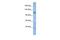 Cullin Associated And Neddylation Dissociated 2 (Putative) antibody, PA5-43591, Invitrogen Antibodies, Western Blot image 