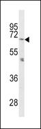 Proprotein Convertase Subtilisin/Kexin Type 2 antibody, 63-050, ProSci, Western Blot image 