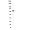 Mesothelin antibody, R31363, NSJ Bioreagents, Western Blot image 