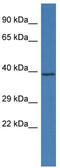 Serine/Threonine/Tyrosine Kinase 1 antibody, TA342380, Origene, Western Blot image 