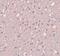 Signal Induced Proliferation Associated 1 Like 3 antibody, PA5-20849, Invitrogen Antibodies, Immunohistochemistry paraffin image 