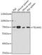 Toll Like Receptor Adaptor Molecule 1 antibody, GTX65931, GeneTex, Western Blot image 