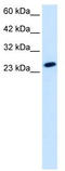 TATA-Box Binding Protein Like 1 antibody, TA339104, Origene, Western Blot image 