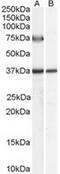 ACOX2 antibody, TA303199, Origene, Western Blot image 