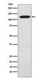 BAF Chromatin Remodeling Complex Subunit BCL11A antibody, M00741, Boster Biological Technology, Western Blot image 