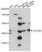 C-type lectin domain family 4 member M antibody, LS-C749274, Lifespan Biosciences, Western Blot image 