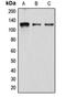 Atrophin 1 antibody, orb213859, Biorbyt, Western Blot image 