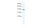 Transcription Elongation Factor A3 antibody, 27-857, ProSci, Enzyme Linked Immunosorbent Assay image 