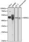 N-Myc Downstream Regulated 1 antibody, STJ24711, St John