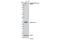 DNA Topoisomerase II Alpha antibody, 13072S, Cell Signaling Technology, Western Blot image 