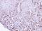 Transforming Acidic Coiled-Coil Containing Protein 2 antibody, GTX110516, GeneTex, Immunohistochemistry paraffin image 