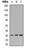 Heterogeneous Nuclear Ribonucleoprotein C (C1/C2) antibody, orb338831, Biorbyt, Western Blot image 