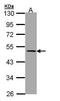 Serpin Family A Member 7 antibody, PA5-21992, Invitrogen Antibodies, Western Blot image 