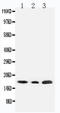 Succinate Dehydrogenase Complex Subunit C antibody, LS-C312982, Lifespan Biosciences, Western Blot image 