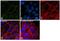 Cadherin 1 antibody, MA5-14458, Invitrogen Antibodies, Immunofluorescence image 