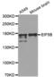 Annexin V-binding protein ABP-7 antibody, abx004515, Abbexa, Western Blot image 