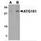 Autophagy Related 101 antibody, MBS150402, MyBioSource, Western Blot image 