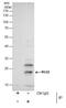 Regulator Of G Protein Signaling 2 antibody, PA5-29708, Invitrogen Antibodies, Immunoprecipitation image 