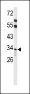 Acyl-coenzyme A thioesterase 8 antibody, 63-804, ProSci, Western Blot image 