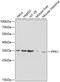 Pyrophosphatase (Inorganic) 1 antibody, GTX32802, GeneTex, Western Blot image 