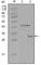 Estrogen Receptor 1 antibody, abx015744, Abbexa, Western Blot image 