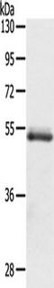 Olfactomedin 4 antibody, TA350252, Origene, Western Blot image 