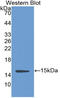 Complement Factor B antibody, LS-C314268, Lifespan Biosciences, Western Blot image 