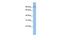 Transmembrane Protein 63B antibody, GTX47281, GeneTex, Western Blot image 