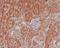 Eukaryotic Translation Initiation Factor 4E antibody, P00135, Boster Biological Technology, Immunohistochemistry frozen image 