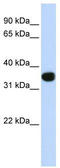 T Cell Leukemia Homeobox 1 antibody, TA330030, Origene, Western Blot image 