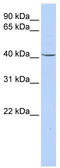 Glycerol-3-phosphate dehydrogenase [NAD+], cytoplasmic antibody, TA346400, Origene, Western Blot image 