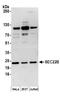 SEC22 Homolog B, Vesicle Trafficking Protein (Gene/Pseudogene) antibody, A304-601A, Bethyl Labs, Western Blot image 