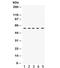 LCK Proto-Oncogene, Src Family Tyrosine Kinase antibody, R31894, NSJ Bioreagents, Western Blot image 