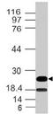 Epstein-Barr Virus Induced 3 antibody, M07190, Boster Biological Technology, Western Blot image 