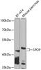 Speckle Type BTB/POZ Protein antibody, 23-060, ProSci, Western Blot image 
