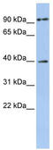 MAGE Family Member A6 antibody, TA339278, Origene, Western Blot image 