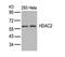Histone Deacetylase 2 antibody, 79-335, ProSci, Western Blot image 