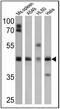 Beta-Secretase 2 antibody, PA1-754, Invitrogen Antibodies, Western Blot image 