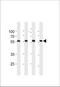 Nuclear Pore Complex Interacting Protein Family Member B15 antibody, TA328191, Origene, Western Blot image 