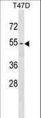 Keratin 79 antibody, LS-C160024, Lifespan Biosciences, Western Blot image 